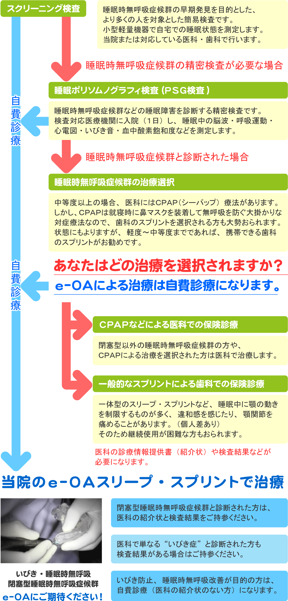いびき・睡眠時無呼吸の治療手順