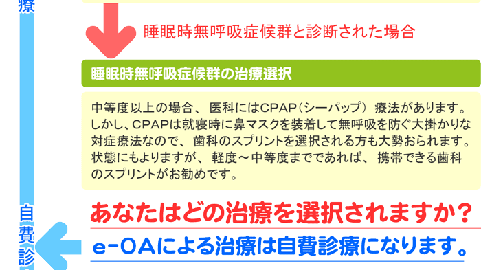 いびき・睡眠時無呼吸の治療手順