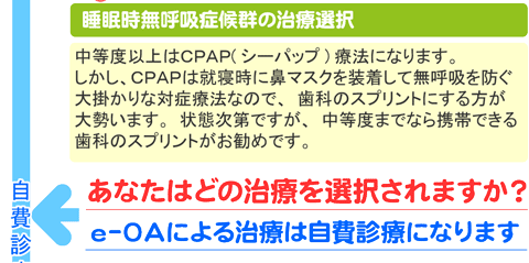 いびき・睡眠時無呼吸の治療手順